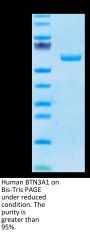 Human BTN3A1/CD277 Protein (BTN-HM2A3)