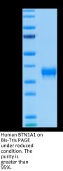 Human BTN1A1/Butyrophilin Protein (BTN-HM4A1)