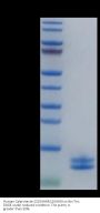 Human Calprotectin (S100A8&S100A9) Protein (CAL-HE101)