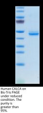 Human CALCA/CGRP Protein (CAL-HM201)