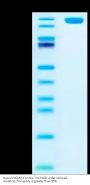 Human NCAM-1/CD56 Protein (CAM-HM256)
