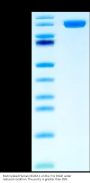 Biotinylated Human NCAM-1/CD56 Protein (CAM-HM456B)