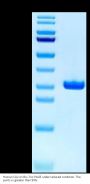 Human CA2/Carbonic anhydrase II Protein (CAS-HM102)