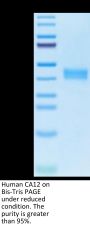 Human CA12/Carbonic anhydrase XII Protein (CAS-HM112)