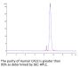 Human CA12/Carbonic anhydrase XII Protein (CAS-HM112)