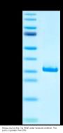 Mouse CA2/Carbonic anhydrase II Protein (CAS-MM102)