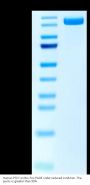 Human PTK7/CCK4 Protein (CCK-HM204)