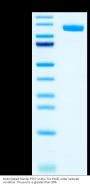 Biotinylated Human PTK7/CCK4 Protein (CCK-HM404B)