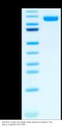Rat PTK7/CCK4 Protein (CCK-RM104)