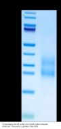 Cynomolgus CCL24 Protein (CCL-CM124)