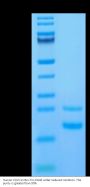 Human CCL5 Protein (CCL-HE105)