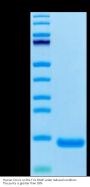 Human CCL11 Protein (CCL-HE111)
