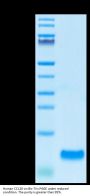 Human CCL20 Protein (CCL-HE120)