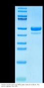 Human CCL24 Protein (CCL-HM224)