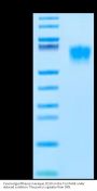 Cynomolgus/Rhesus macaque CD19 Protein (CD1-CM129)