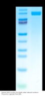 Human CD117 Protein (CD1-HM217)