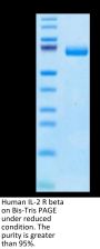 Human IL-2 R beta/CD122 Protein (CD1-HM222)