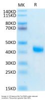 Human IL-2 R beta/CD122 Protein (CD1-HM422)