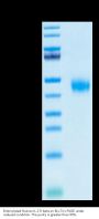 Biotinylated Human IL-2 R beta/CD122 Protein (CD1-HM422B)