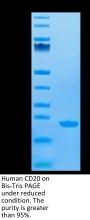 Human CD20/MS4A1 Protein (CD2-HE120)