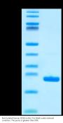 Biotinylated Human CD20/MS4A1 Protein (CD2-HE120B)
