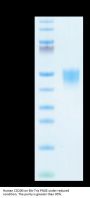 Human CD200/OX-2 Protein (CD2-HM120)