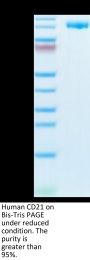 Human CD21 Protein (CD2-HM121)
