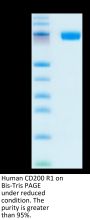 Human CD200 R1/CRTR2 Protein (CD2-HM2R1)