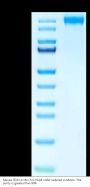 Mouse CD21 Protein (CD2-MM121)