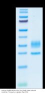 Human CD3E&CD3D/CD3 epsilon&CD3 delta Protein (CD3-HM105)