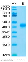 Human CD23/Fc epsilon RII Protein (CD3-HM123)
