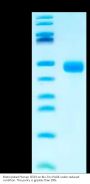 Biotinylated Human CD23/Fc epsilon RII Protein (CD3-HM123B)