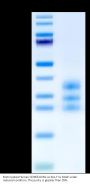 Biotinylated Human CD3E&CD3G/CD3 epsilon&CD3 gamma Protein (Primary Amine Labeling) (CD3-HM157B)