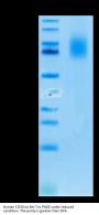 Human CD30/TNFRSF8 Protein (CD3-HM430)