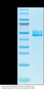 Biotinylated Human CD3E&CD3G/CD3 epsilon&CD3 gamma Protein (CD3-HM557B)
