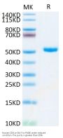 Human CD4/LEU3 Protein (CD4-HM401)