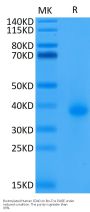 Biotinylated Human CD40/TNFRSF5 Protein (CD4-HM440B)