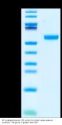 FITC-Labeled Human CD5 Protein (CD5-HM101F)