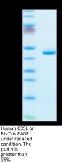Human CD5L Protein (CD5-HM10L)