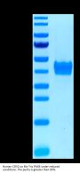 Human CD52 Protein (CD5-HM352)