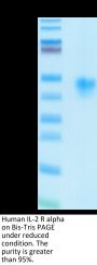Human IL-2 R alpha/CD25 Protein (CD5-HM425)