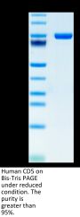 Human CD5 Protein, Ultra Low Endotoxin (CD5-HM501-UL)