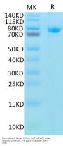 Biotinylated Human CD5 Protein (CD5-HM501B)