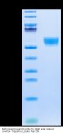 Biotinylated Mouse CD5 Protein (Primary Amine Labeling) (CD5-MM101B)