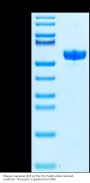 Rhesus macaque CD5 Protein (CD5-RM405)