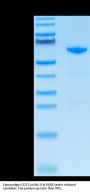Cynomolgus CD73/NT5E Protein (CD7-CM173)