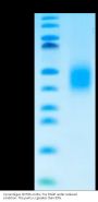 Cynomolgus CD79A Protein (CD7-CM19A)