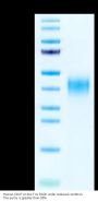 Human CD47 Protein (CD7-HM047)