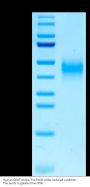 Human CD47 Protein (CD7-HM147)