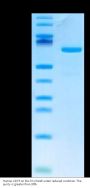 Human CD73/NT5E Protein (CD7-HM173)